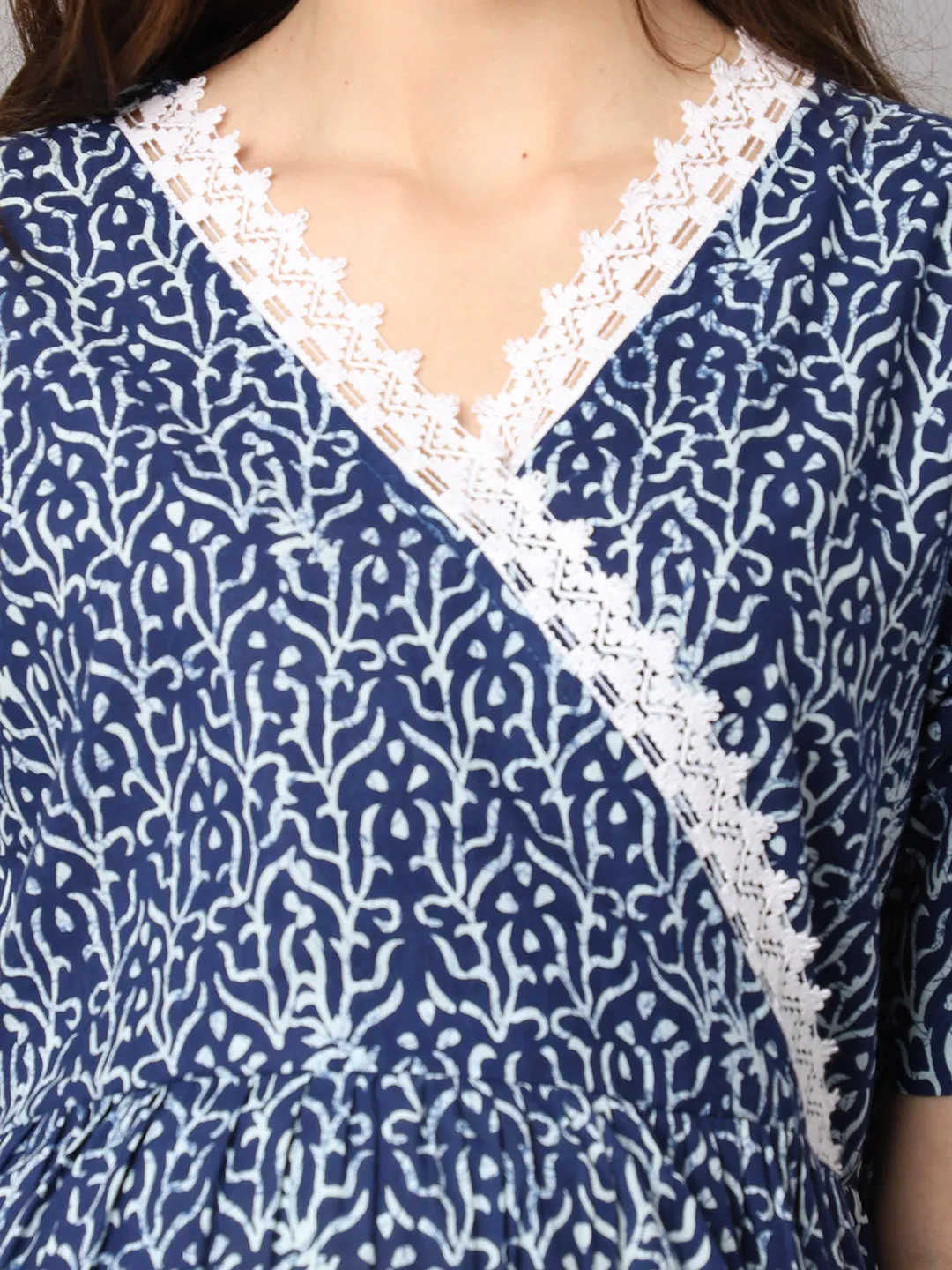 Women's Cotton Lace Printed Pre and Post Maternity Dress with Feeding